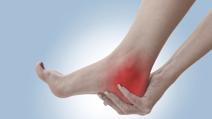 Camas Chiropractic Treatment for Plantar Fasciitis